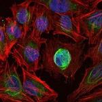 MMP1 Antibody in Immunocytochemistry (ICC/IF)