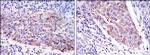 MMP1 Antibody in Immunohistochemistry (Paraffin) (IHC (P))