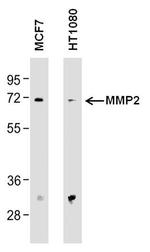 MMP2 Monoclonal Antibody (F14 P4 D3)