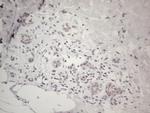 MMP2 Antibody in Immunohistochemistry (Paraffin) (IHC (P))