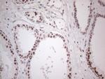 MMP2 Antibody in Immunohistochemistry (Paraffin) (IHC (P))
