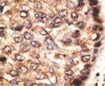 MMP24 Antibody in Immunohistochemistry (IHC)