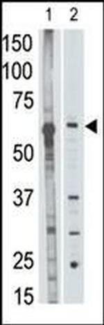 MMP25 Antibody in Western Blot (WB)