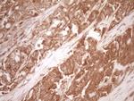 MMP3 Antibody in Immunohistochemistry (Paraffin) (IHC (P))