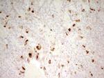 MMP3 Antibody in Immunohistochemistry (Paraffin) (IHC (P))