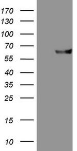 MMP3 Antibody in Western Blot (WB)