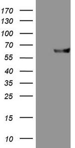 MMP3 Antibody in Western Blot (WB)