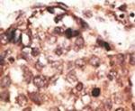 MMP8 Antibody in Immunohistochemistry (IHC)