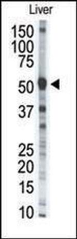 MMP8 Antibody in Western Blot (WB)