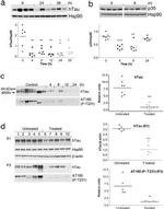 Tau Antibody in Western Blot (WB)