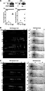 Tau Antibody in Western Blot (WB)
