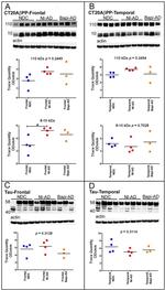 Tau Antibody in Western Blot (WB)