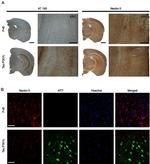 Tau Antibody in Immunohistochemistry (IHC)