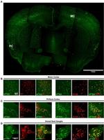 Tau Antibody in Immunohistochemistry (IHC)