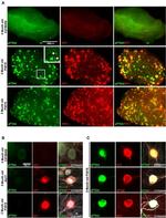 Tau Antibody in Immunohistochemistry (IHC)