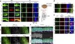 Tau Antibody in Immunohistochemistry (IHC)