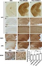 Tau Antibody in Immunohistochemistry (IHC)