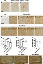 Tau Antibody in Immunohistochemistry (IHC)