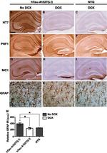 Tau Antibody in Immunohistochemistry (IHC)