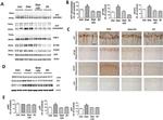 Tau Antibody in Western Blot, Immunohistochemistry (WB, IHC)