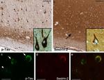 Phospho-Tau (Ser202, Thr205) Antibody in Immunohistochemistry (IHC)