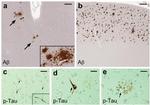 Phospho-Tau (Ser202, Thr205) Antibody in Immunohistochemistry (IHC)