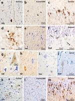 Phospho-Tau (Ser202, Thr205) Antibody in Immunohistochemistry (IHC)