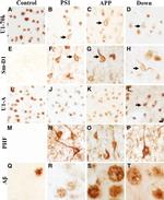 Phospho-Tau (Ser202, Thr205) Antibody in Immunohistochemistry (IHC)