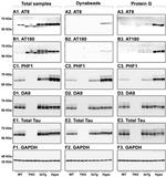 Phospho-Tau (Thr231) Antibody in Western Blot (WB)