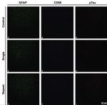 Phospho-Tau (Ser202, Thr205) Antibody in Immunohistochemistry (IHC)