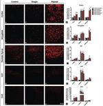 Phospho-Tau (Ser202, Thr205) Antibody in Immunohistochemistry (IHC)