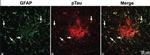 Phospho-Tau (Ser202, Thr205) Antibody in Immunohistochemistry (IHC)
