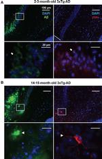 Phospho-Tau (Ser202, Thr205) Antibody in Immunocytochemistry (ICC/IF)