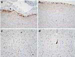 Phospho-Tau (Ser202, Thr205) Antibody in Immunohistochemistry (IHC)