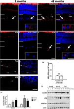 Phospho-Tau (Ser202, Thr205) Antibody in Western Blot, Immunohistochemistry (WB, IHC)