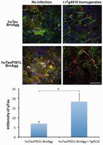 Phospho-Tau (Ser202, Thr205) Antibody in Immunohistochemistry (IHC)
