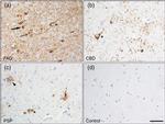 Phospho-Tau (Ser202, Thr205) Antibody in Immunohistochemistry (Paraffin) (IHC (P))