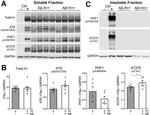 Phospho-Tau (Thr181) Antibody in Western Blot (WB)