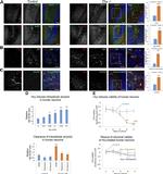 Phospho-Tau (Ser202, Thr205) Antibody in Immunohistochemistry (IHC)
