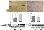 Phospho-Tau (Thr231) Antibody in Western Blot, Immunohistochemistry (WB, IHC)