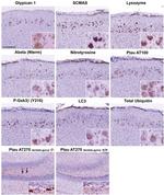Phospho-Tau (Thr181) Antibody in Immunohistochemistry (IHC)