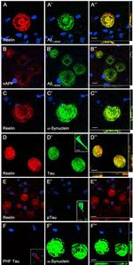 Phospho-Tau (Thr212, Ser214) Antibody in Immunohistochemistry (IHC)