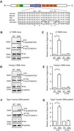 Phospho-Tau (Thr212, Ser214) Antibody in Western Blot (WB)