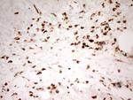 MNDA Antibody in Immunohistochemistry (Paraffin) (IHC (P))