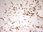 MNDA Antibody in Immunohistochemistry (Paraffin) (IHC (P))