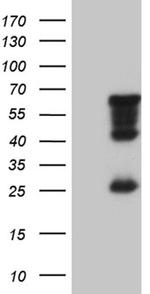 MNS1 Antibody in Western Blot (WB)