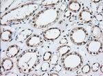 MOBKL1A Antibody in Immunohistochemistry (Paraffin) (IHC (P))