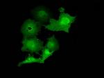 MOBKL2B Antibody in Immunocytochemistry (ICC/IF)