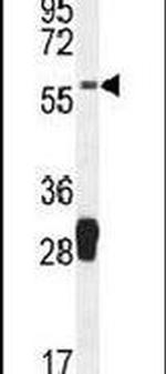 MOCS1 Antibody in Western Blot (WB)