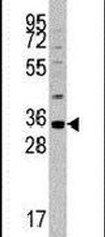 MOGAT2 Antibody in Western Blot (WB)